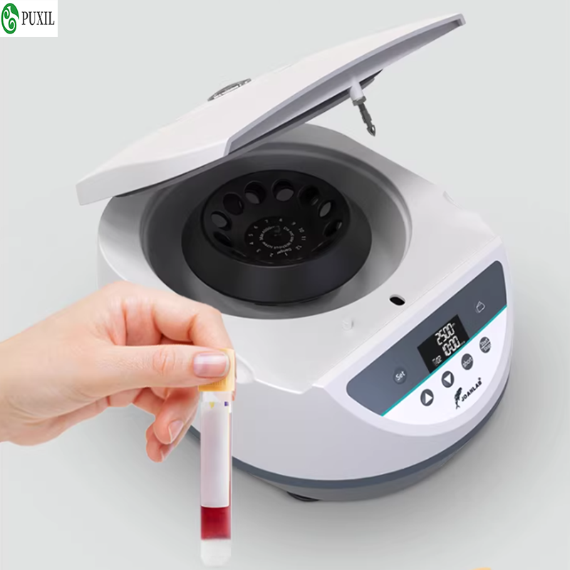 Wirówka plazmowa AB laboratory – Blood Collection Tube recenzja i cena